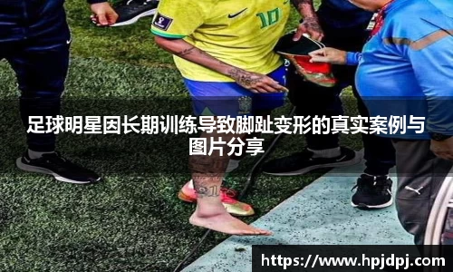 足球明星因长期训练导致脚趾变形的真实案例与图片分享